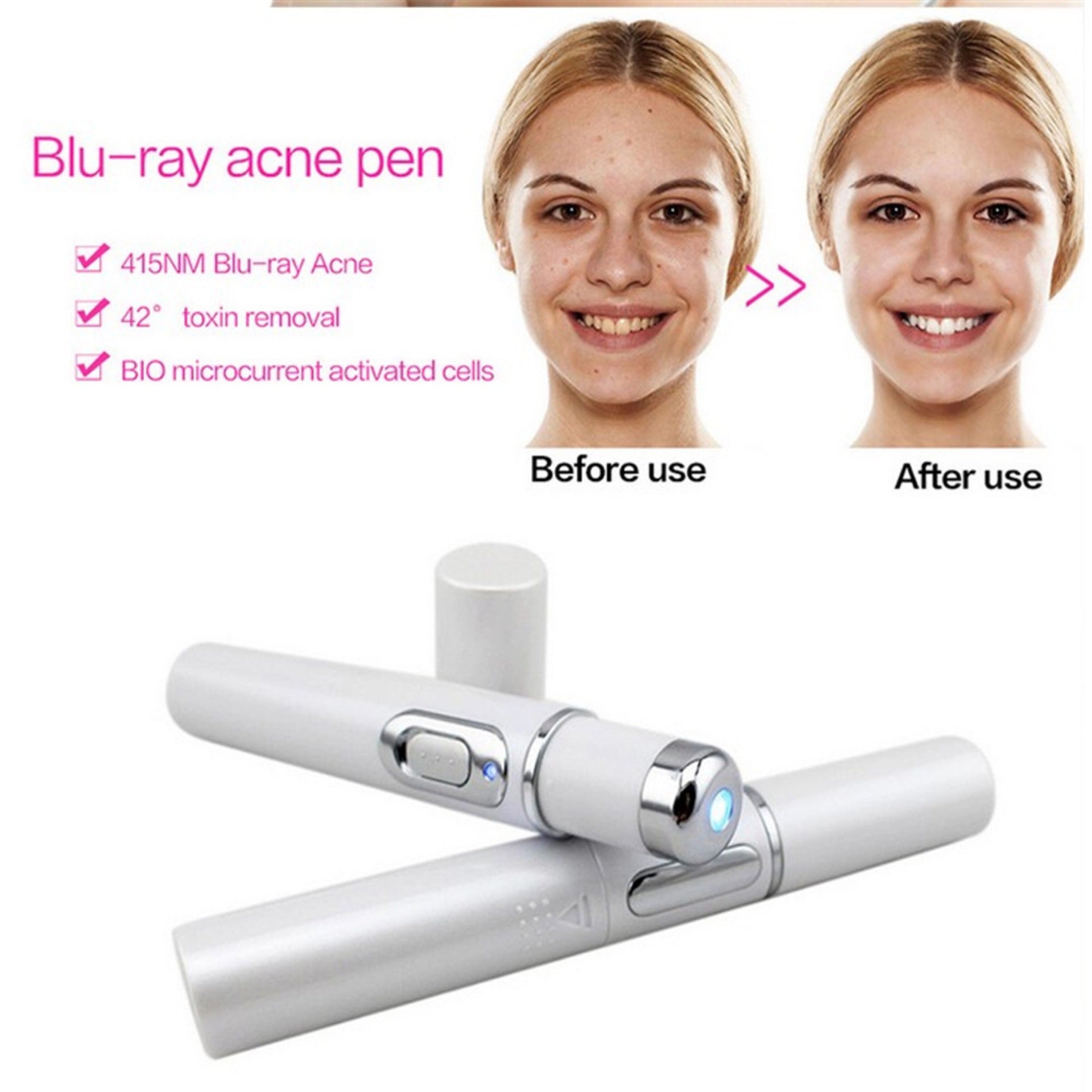 Blue Light Therapy Laser olovka za lice