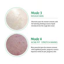 Skincare Tool Wireless Microneedle Roller Pen Digital Display Beauty Device With 10pcs Replaceable Needle Heads