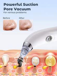 Teckwe Blackhead Vacuum Remover, Powerful Portable Facial Pore Cleaner With 4 Probes, Remove Blackhead In Gentle And Way Without Squeezing Pain For Women And Men. Your Personal Professional Beautician.