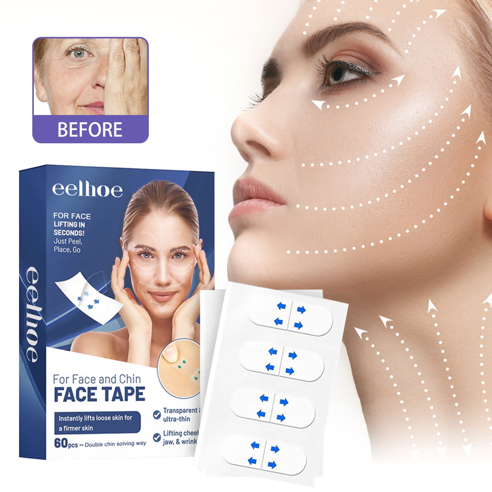 Trake za  Face Lifting