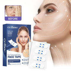 Trake za  Face Lifting