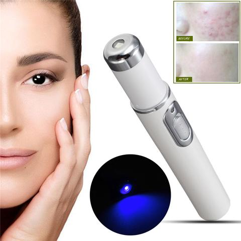 Blue Light Therapy Laser olovka za lice