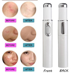 Blue Light Therapy Laser olovka za lice