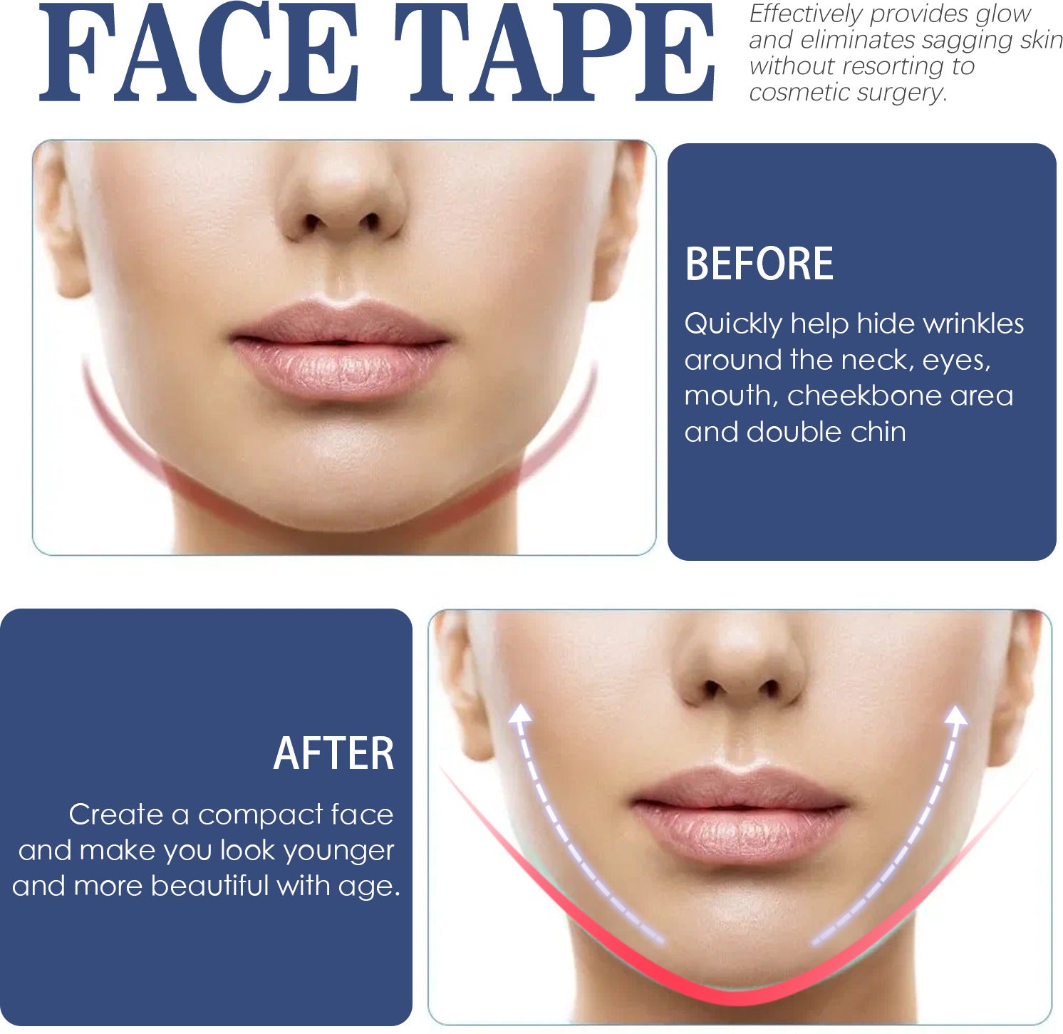Trake za  Face Lifting